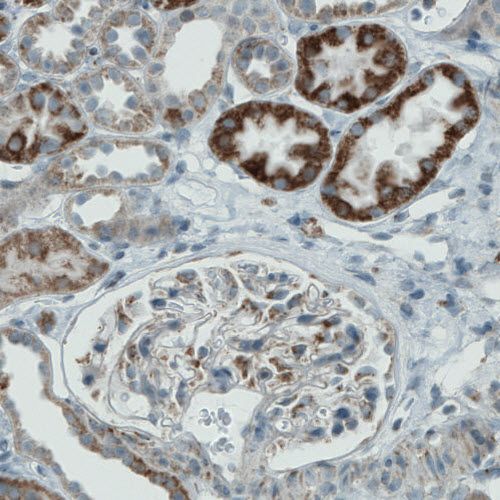 Immunohistochemistry (Formalin/PFA-fixed paraffin-embedded sections) - Anti-PGAM5 antibody [CL0624] (ab244218), expandable thumbnail