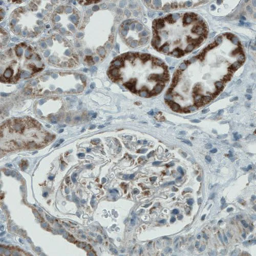 Immunohistochemistry (Formalin/PFA-fixed paraffin-embedded sections) - Anti-PGAM5 antibody [CL0624] (AB244218)
