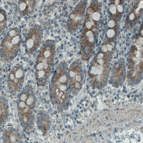 Immunohistochemistry (Formalin/PFA-fixed paraffin-embedded sections) - Anti-PGAM5 antibody [CL0624] (AB244218)