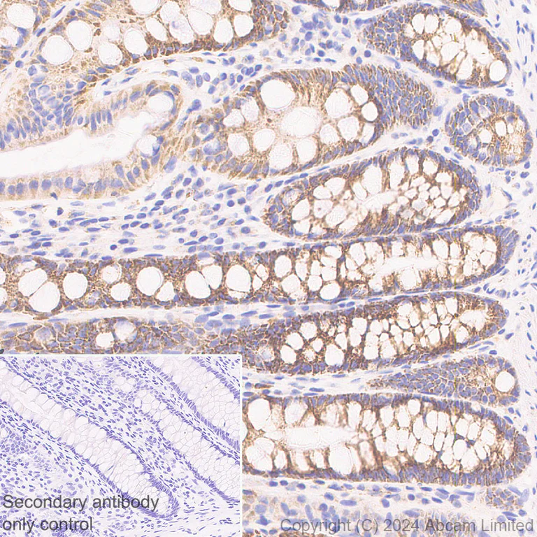 Immunohistochemistry (Formalin/PFA-fixed paraffin-embedded sections) - Anti-PGAM5 antibody [RM1254] (AB322207)