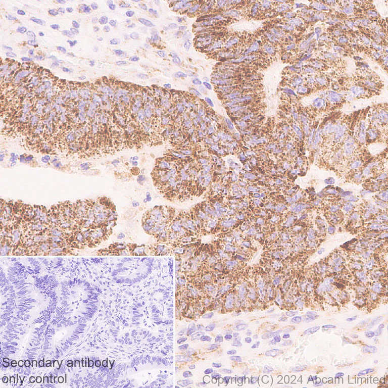 Immunohistochemistry (Formalin/PFA-fixed paraffin-embedded sections) - Anti-PGAM5 antibody [RM1254] (AB322207)