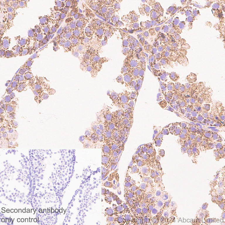 Immunohistochemistry (Formalin/PFA-fixed paraffin-embedded sections) - Anti-PGAM5 antibody [RM1254] (AB322207)