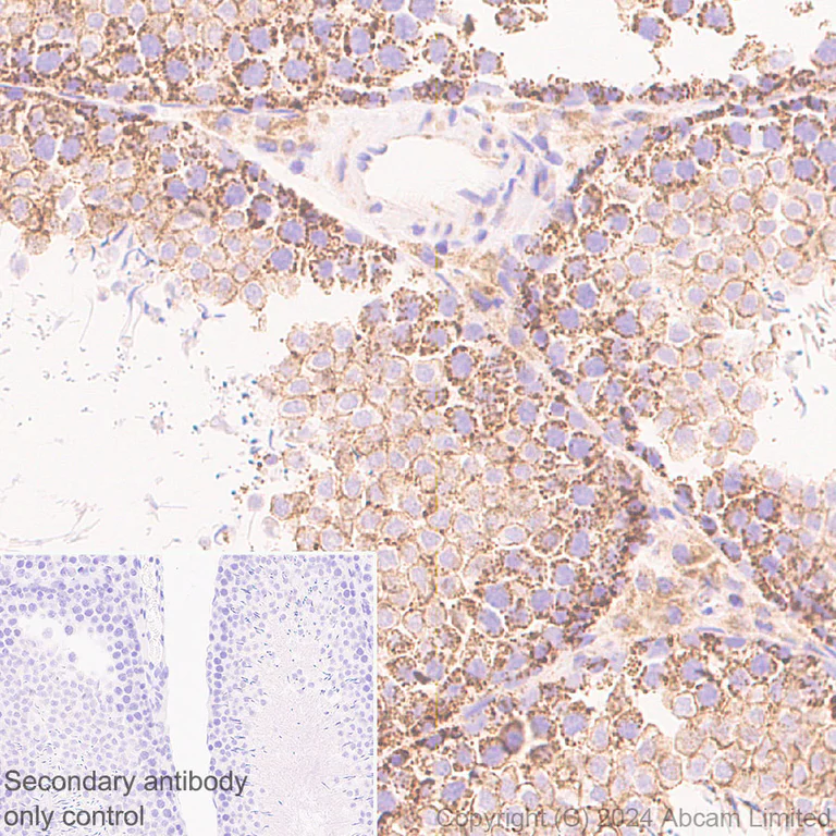 Immunohistochemistry (Formalin/PFA-fixed paraffin-embedded sections) - Anti-PGAM5 antibody [RM1254] (AB322207)