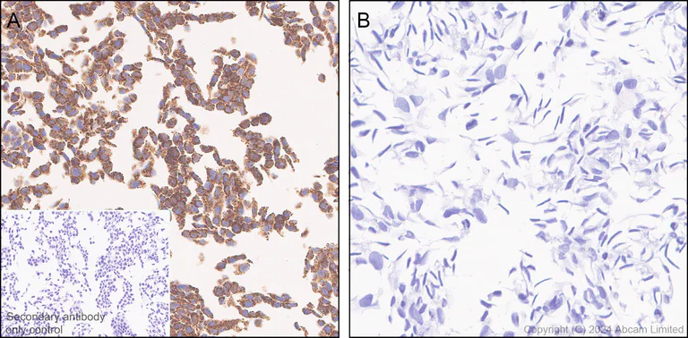 Immunohistochemistry (Formalin/PFA-fixed paraffin-embedded sections) - Anti-PGAM5 antibody [RM1254] (AB322207)