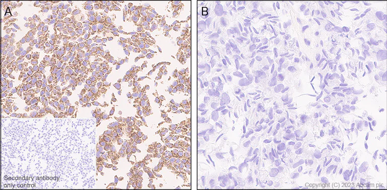 Immunohistochemistry (Formalin/PFA-fixed paraffin-embedded sections) - Anti-PGAM5 (Long isoform) antibody [EPR27145-21] (AB308447)