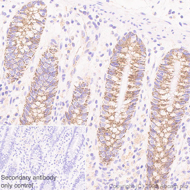 Immunohistochemistry (Formalin/PFA-fixed paraffin-embedded sections) - Anti-PGAM5 (Long isoform) antibody [EPR27145-21] (AB308447)