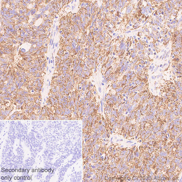 Immunohistochemistry (Formalin/PFA-fixed paraffin-embedded sections) - Anti-PGAM5 (Long isoform) antibody [EPR27145-21] (AB308447)