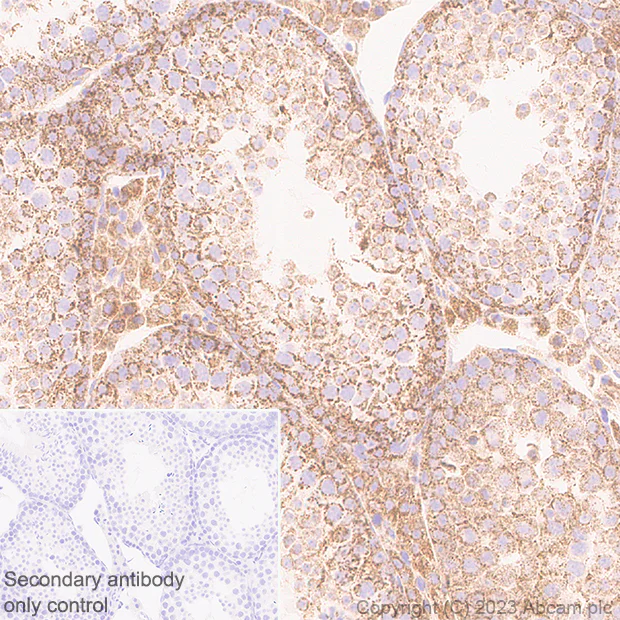 Immunohistochemistry (Formalin/PFA-fixed paraffin-embedded sections) - Anti-PGAM5 (Long isoform) antibody [EPR27145-21] (AB308447)