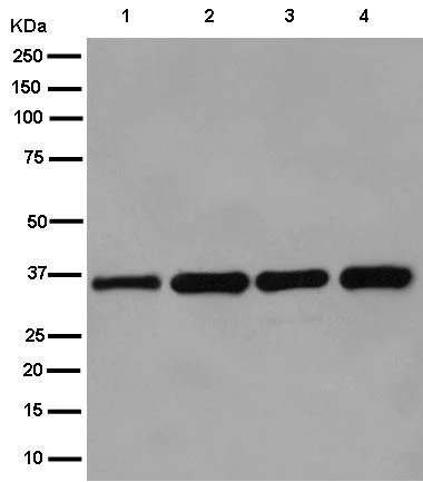 Western blot - Anti-PGAP3 antibody [EPR14380] - BSA and Azide free (AB250622)