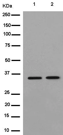 Western blot - Anti-PGAP3 antibody [EPR14380] - BSA and Azide free (AB250622)