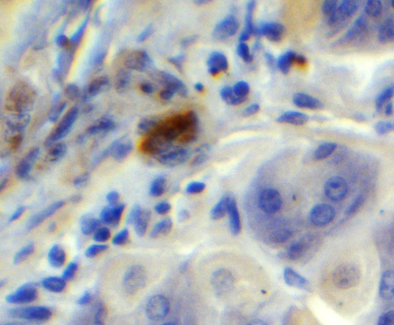 Immunohistochemistry (Formalin/PFA-fixed paraffin-embedded sections) - Anti-PGC1 alpha antibody (AB191838)
