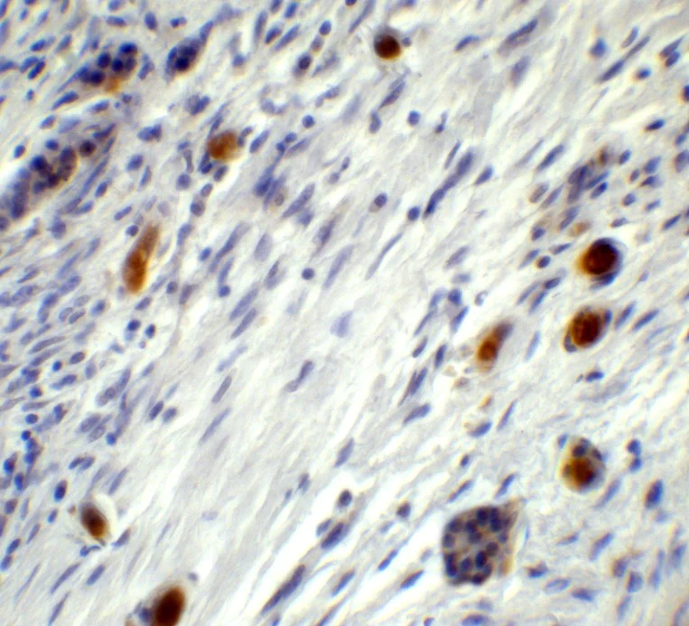 Immunohistochemistry (Formalin/PFA-fixed paraffin-embedded sections) - Anti-PGC1 alpha antibody (AB191838)