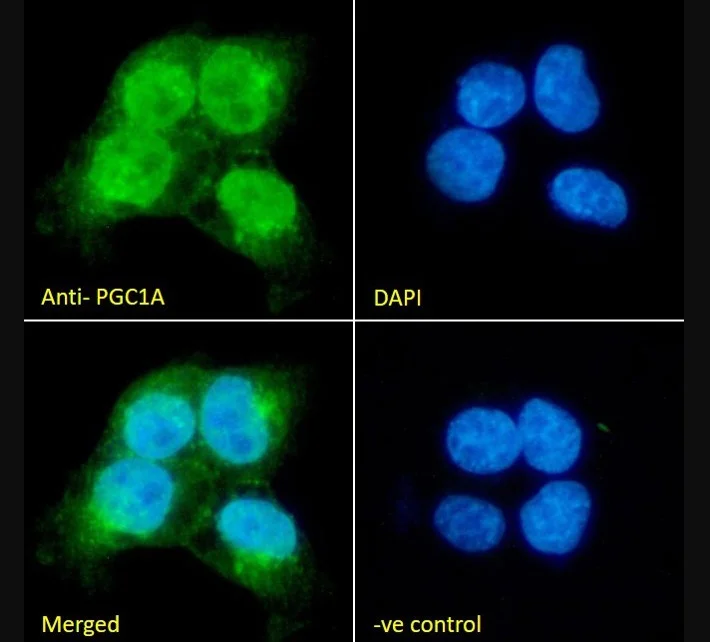 Immunocytochemistry/ Immunofluorescence - Anti-PGC1 alpha antibody (AB317540)