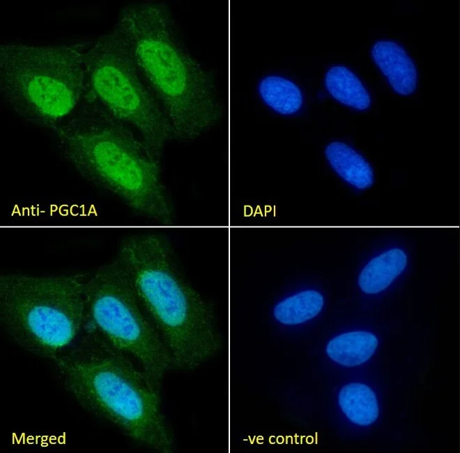 Immunocytochemistry/ Immunofluorescence - Anti-PGC1 alpha antibody (AB317540)