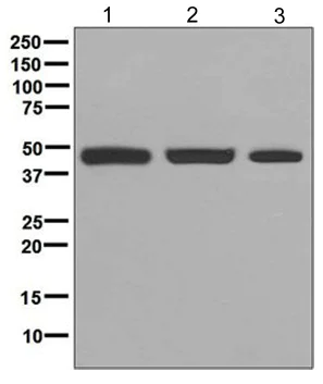 Western blot - Anti-PGD antibody [EPR6565] (AB129199)