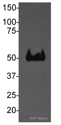 Western blot - Anti-PGK1 antibody [22C5D8] (AB113687)