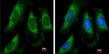 Immunocytochemistry/ Immunofluorescence - Anti-PGK1 antibody (ab154613), expandable thumbnail