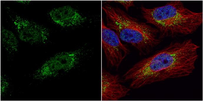 Immunocytochemistry/ Immunofluorescence - Anti-PGK1 antibody (AB154613)