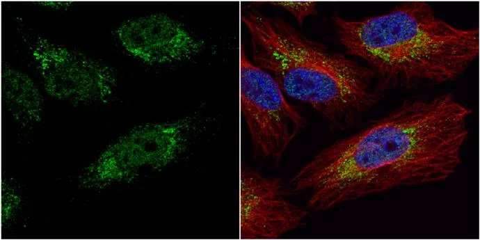 Immunocytochemistry/ Immunofluorescence - Anti-PGK1 antibody (AB154613)