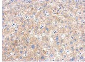 Immunohistochemistry (Formalin/PFA-fixed paraffin-embedded sections) - Anti-PGK1 antibody (AB154613), expandable thumbnail