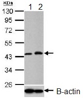 Western blot - Anti-PGK1 antibody (AB154613), expandable thumbnail