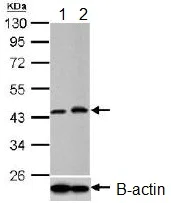 Western blot - Anti-PGK1 antibody (AB154613)