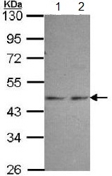 Western blot - Anti-PGK1 antibody (AB154613), expandable thumbnail