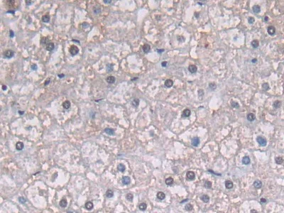 Immunohistochemistry (Formalin/PFA-fixed paraffin-embedded sections) - Anti-PGK1 antibody (AB233135)