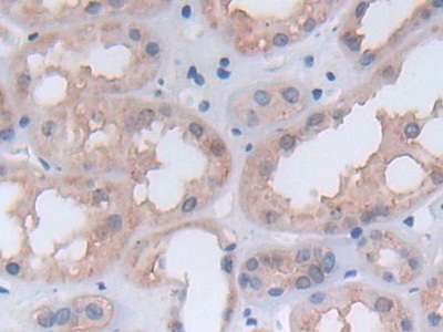 Immunohistochemistry (Formalin/PFA-fixed paraffin-embedded sections) - Anti-PGK1 antibody (AB233135)