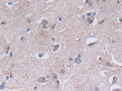 Immunohistochemistry (Formalin/PFA-fixed paraffin-embedded sections) - Anti-PGK1 antibody (AB233135)