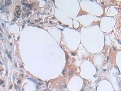 Immunohistochemistry (Formalin/PFA-fixed paraffin-embedded sections) - Anti-PGK1 antibody (AB233135)