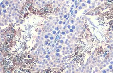 Immunohistochemistry paraffin embedded sections - Anti-PGK1 + PGK2 antibody [HL1775] (AB308196)