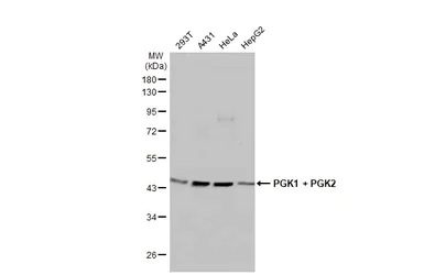 Western blot - Anti-PGK1 + PGK2 antibody [HL1775] (AB308196)