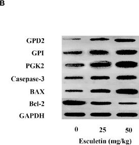 Western blot - Anti-PGK2 antibody [EPR14909(B)] (AB183031)