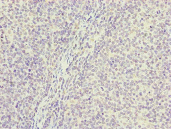 Immunohistochemistry (Formalin/PFA-fixed paraffin-embedded sections) - Anti-PGLS antibody (AB229872)