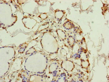 Immunohistochemistry (Formalin/PFA-fixed paraffin-embedded sections) - Anti-PGLS antibody (AB229872)