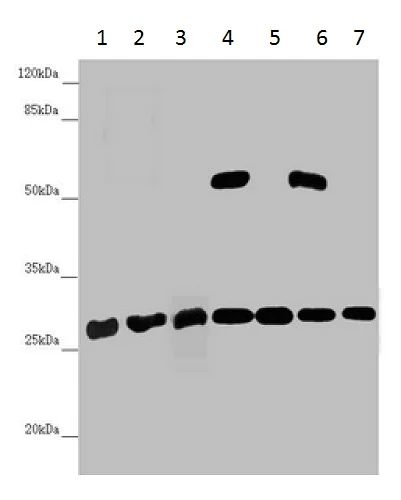 Western blot - Anti-PGLS antibody (AB229872)