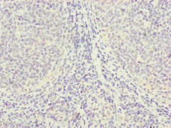 Immunohistochemistry (Formalin/PFA-fixed paraffin-embedded sections) - Anti-PGLS antibody (AB229980)