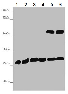 Western blot - Anti-PGLS antibody (AB229980), expandable thumbnail