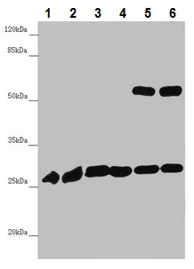 Western blot - Anti-PGLS antibody (AB229980)