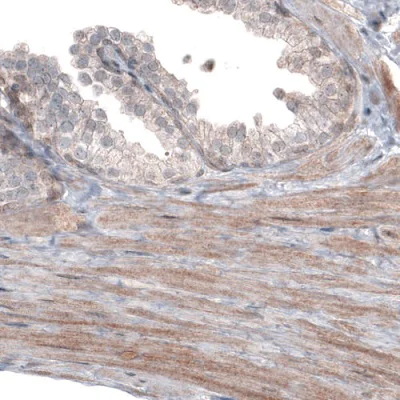 Immunohistochemistry (Formalin/PFA-fixed paraffin-embedded sections) - Anti-PGM1 antibody [CL3299] (AB223469)