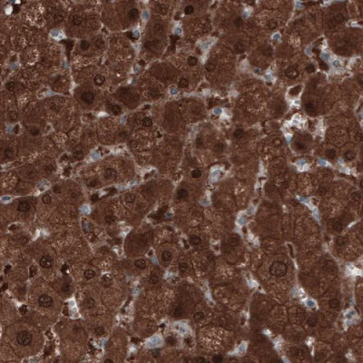 Immunohistochemistry (Formalin/PFA-fixed paraffin-embedded sections) - Anti-PGM1 antibody [CL3299] (AB223469)