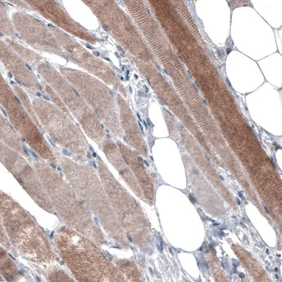 Immunohistochemistry (Formalin/PFA-fixed paraffin-embedded sections) - Anti-PGM1 antibody [CL3299] (AB223469)