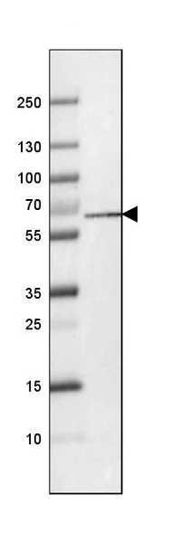 Western blot - Anti-PGM1 antibody [CL3299] (AB223469)