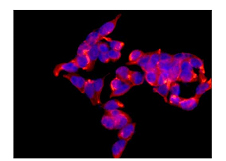 Immunocytochemistry/ Immunofluorescence - Anti-PGM1 antibody [EPR15240] (AB188869)