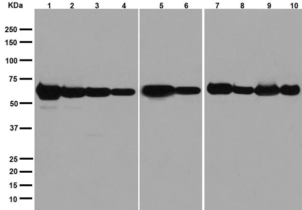 Western blot - Anti-PGM1 antibody [EPR15241] - BSA and Azide free (AB251158)