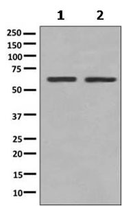 Western blot - Anti-PGM2 antibody [PGM2] - BSA and Azide free (AB249080), expandable thumbnail