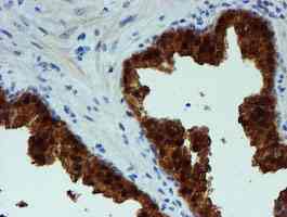 Immunohistochemistry (Formalin/PFA-fixed paraffin-embedded sections) - Anti-PGM3 antibody [OTI1A11] (ab128094), expandable thumbnail