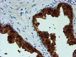 Immunohistochemistry (Formalin/PFA-fixed paraffin-embedded sections) - Anti-PGM3 antibody [OTI1A11] (AB128094)