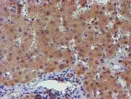 Immunohistochemistry (Formalin/PFA-fixed paraffin-embedded sections) - Anti-PGM3 antibody [OTI1A11] (AB128094), expandable thumbnail